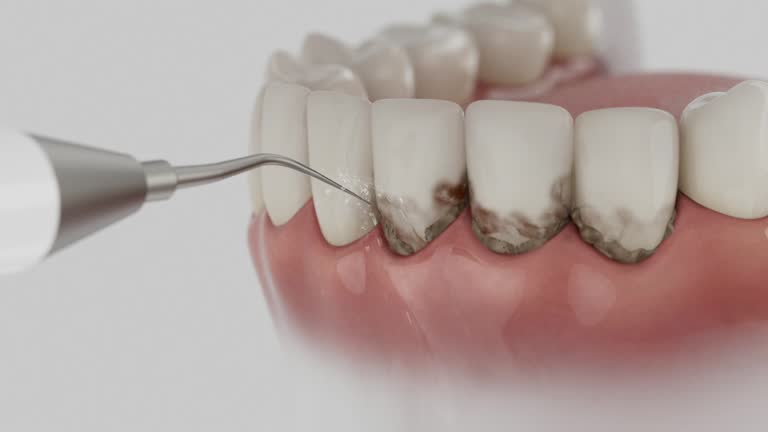 Reliable Dental Implants contractor in Brady, TX by Smile Center Dentistry